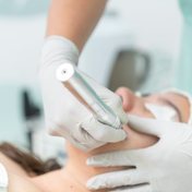 Microneedling con dermapen sobre el rostro