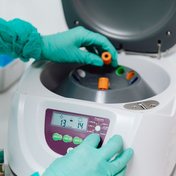 Centrifugado de la muestra para plasma rico en plaquetas